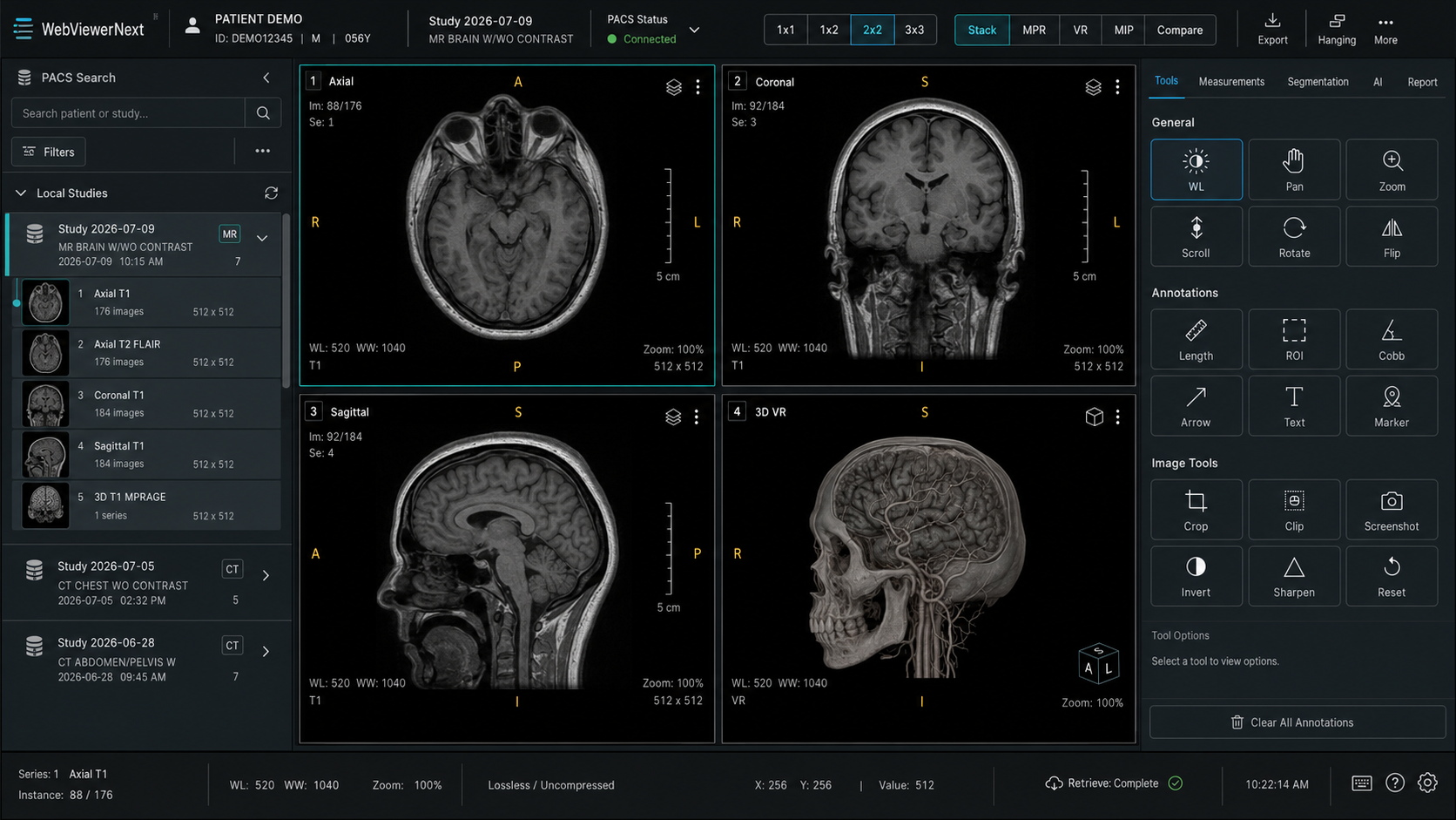 MedView MR Viewer